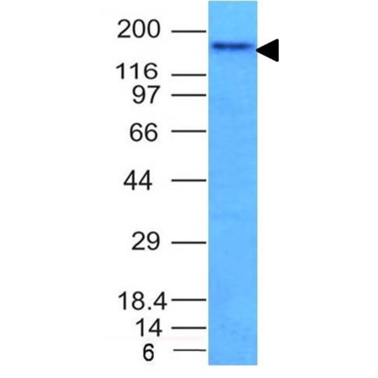 Western Blot - Anti-NCAM1 Antibody [NCAM1/795] - BSA and Azide free (A252660) - Antibodies.com