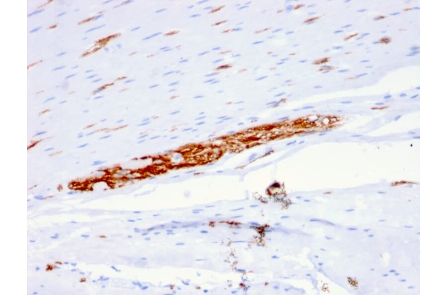 Immunohistochemistry - Anti-NCAM1 Antibody [ERIC-1] - BSA and Azide free (A252661) - Antibodies.com