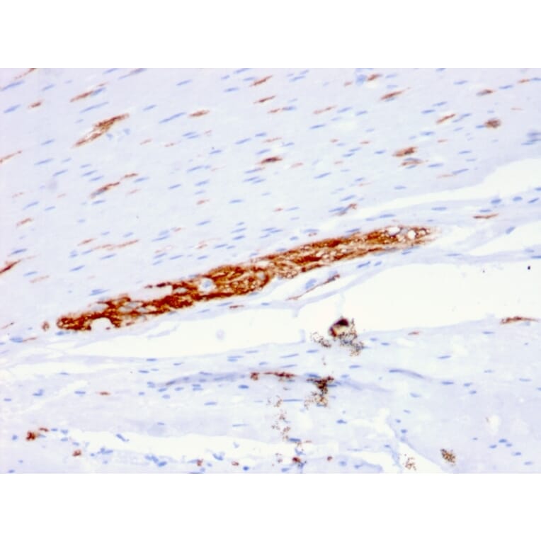 Immunohistochemistry - Anti-NCAM1 Antibody [ERIC-1] - BSA and Azide free (A252661) - Antibodies.com