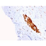 Immunohistochemistry - Anti-NCAM1 Antibody [ERIC-1] - BSA and Azide free (A252660) - Antibodies.com