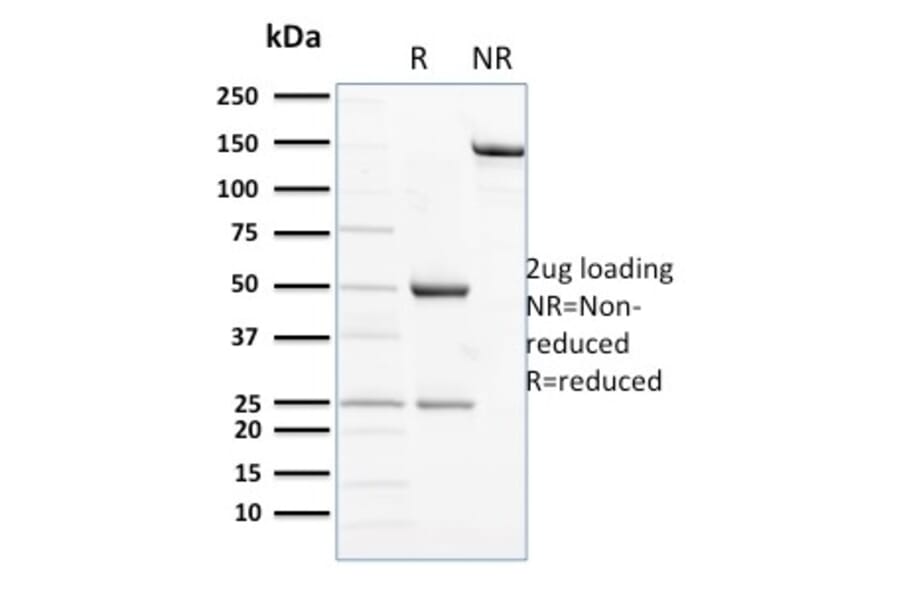 SDS-PAGE - Anti-NCAM1 Antibody [ERIC-1] - BSA and Azide free (A252661) - Antibodies.com
