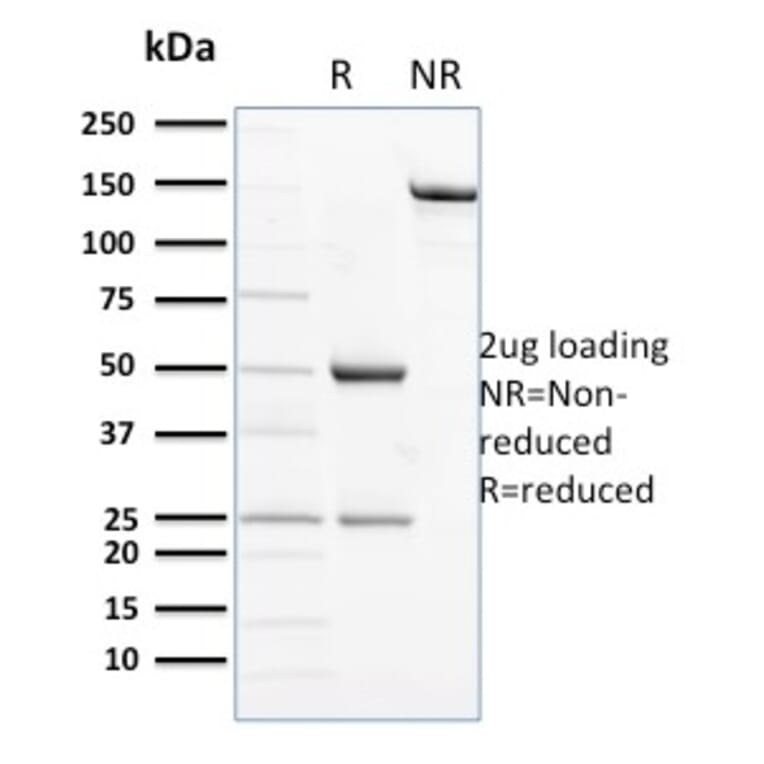 SDS-PAGE - Anti-NCAM1 Antibody [ERIC-1] - BSA and Azide free (A252661) - Antibodies.com