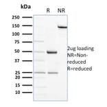 SDS-PAGE - Anti-NCAM1 Antibody [ERIC-1] - BSA and Azide free (A252661) - Antibodies.com