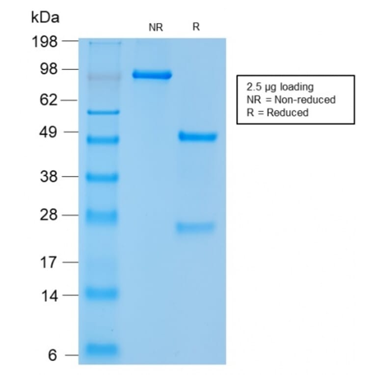 SDS-PAGE - Anti-NCAM1 Antibody [NCAM1/2217R] - BSA and Azide free (A252662) - Antibodies.com