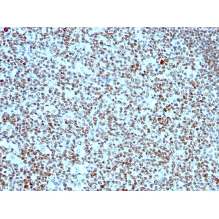 Immunohistochemistry - Anti-Nucleolin Antibody [SPM614] - BSA and Azide free (A252664) - Antibodies.com