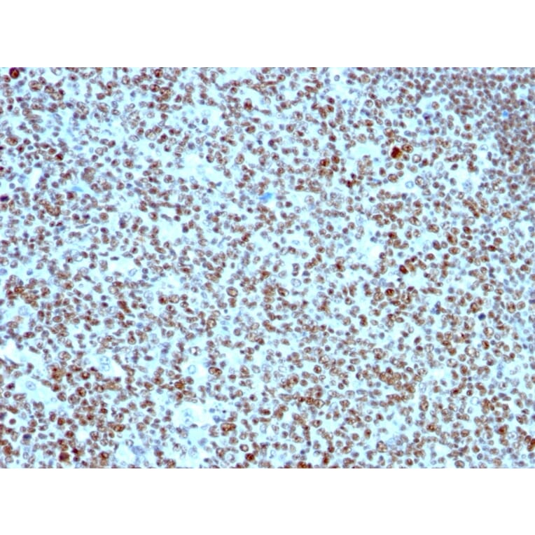 Immunohistochemistry - Anti-Nucleolin Antibody [364-5] - BSA and Azide free (A252665) - Antibodies.com