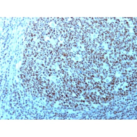 Immunohistochemistry - Anti-Nucleolin Antibody [364-5 + NCL/902] - BSA and Azide free (A252666) - Antibodies.com