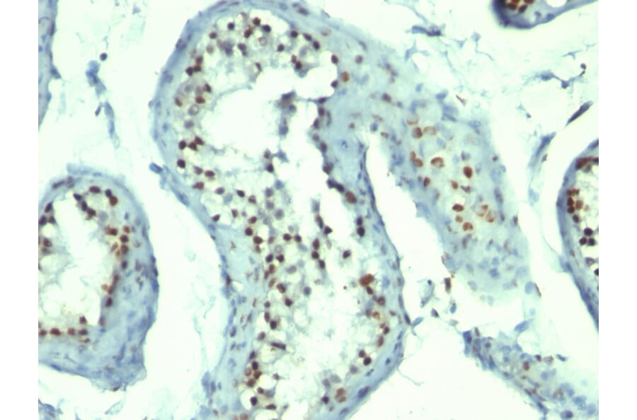 Immunohistochemistry - Anti-Nucleolin Antibody [364-5 + NCL/902] - BSA and Azide free (A252666) - Antibodies.com