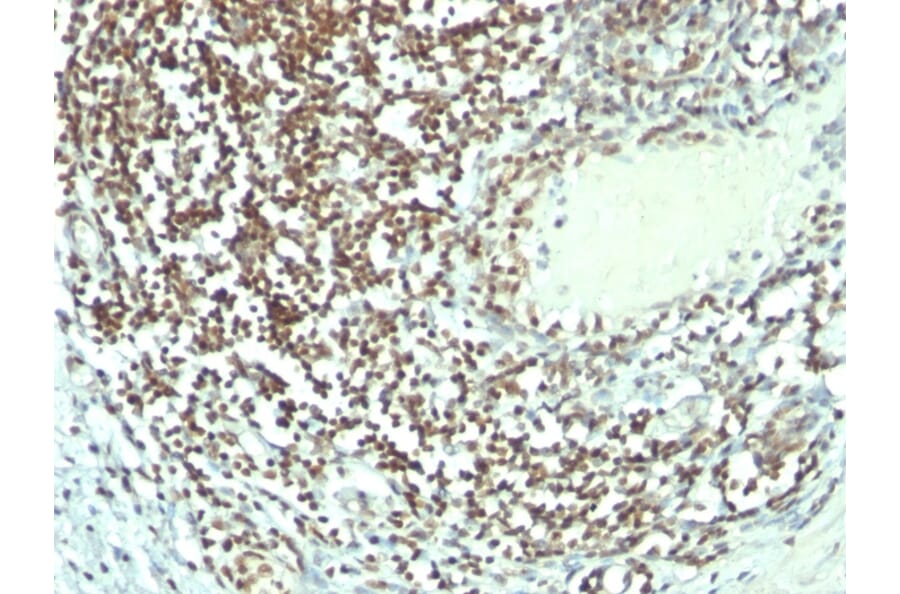 Immunohistochemistry - Anti-Nucleolin Antibody [364-5 + NCL/902] - BSA and Azide free (A252666) - Antibodies.com