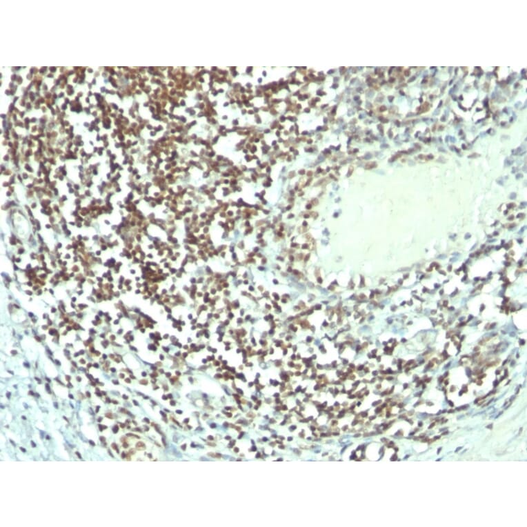 Immunohistochemistry - Anti-Nucleolin Antibody [364-5 + NCL/902] - BSA and Azide free (A252666) - Antibodies.com