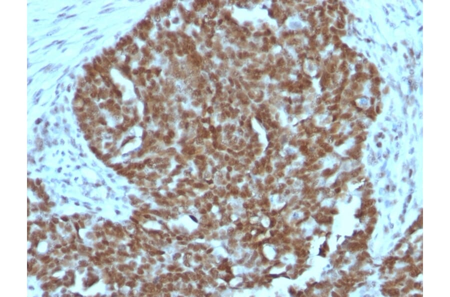 Immunohistochemistry - Anti-Nucleolin Antibody [364-5 + NCL/902] - BSA and Azide free (A252666) - Antibodies.com