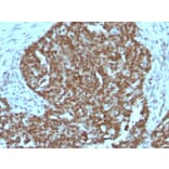 Immunohistochemistry - Anti-Nucleolin Antibody [364-5 + NCL/902] - BSA and Azide free (A252666) - Antibodies.com