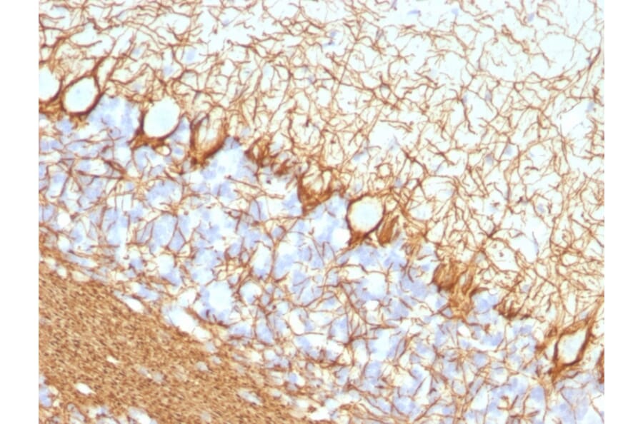 Immunohistochemistry - Anti-Neurofilament Heavy Polypeptide Antibody [NF421] - BSA and Azide free (A252667) - Antibodies.com