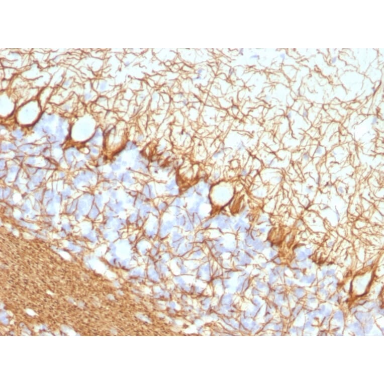Immunohistochemistry - Anti-Neurofilament Heavy Polypeptide Antibody [NF421] - BSA and Azide free (A252667) - Antibodies.com