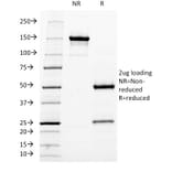 SDS-PAGE - Anti-Neurofilament Heavy Polypeptide Antibody [NF421] - BSA and Azide free (A252667) - Antibodies.com