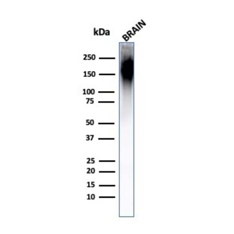 Western Blot - Anti-Neurofilament Heavy Polypeptide Antibody [NF421] - BSA and Azide free (A252667) - Antibodies.com