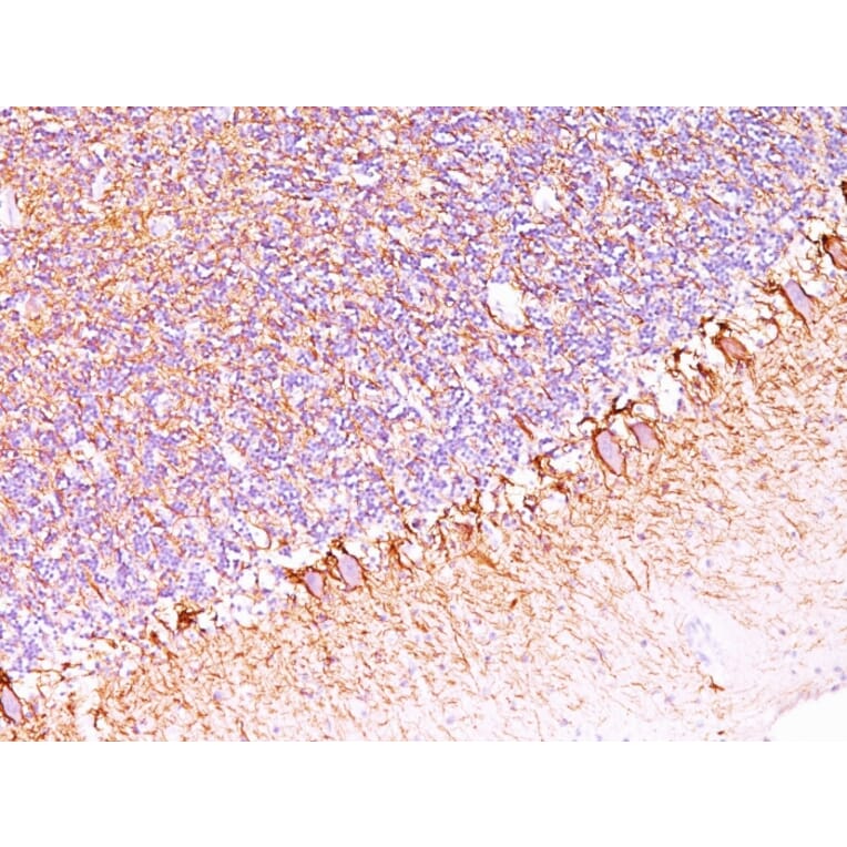 Immunohistochemistry - Anti-Neurofilament Heavy Polypeptide Antibody [SPM563] - BSA and Azide free (A252667) - Antibodies.com