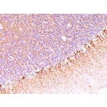 Immunohistochemistry - Anti-Neurofilament Heavy Polypeptide Antibody [SPM563] - BSA and Azide free (A252667) - Antibodies.com