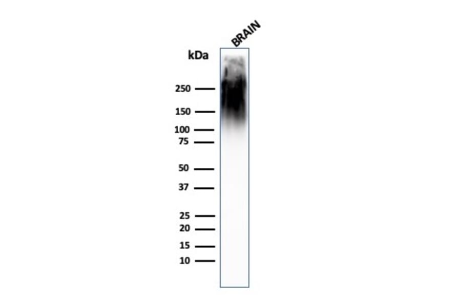Western Blot - Anti-Neurofilament Heavy Polypeptide Antibody [SPM563] - BSA and Azide free (A252668) - Antibodies.com