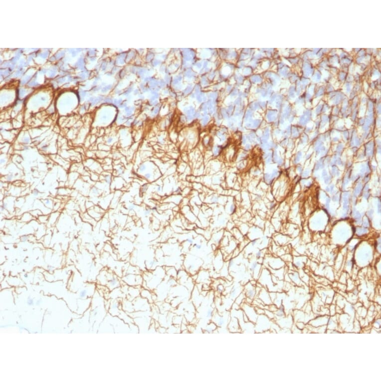 Immunohistochemistry - Anti-Neurofilament Heavy Polypeptide Antibody [RT97] - BSA and Azide free (A252669) - Antibodies.com