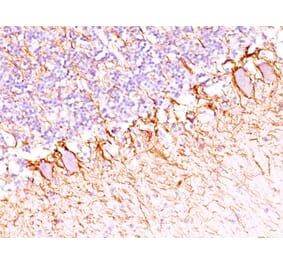 Immunohistochemistry - Anti-Neurofilament Heavy Polypeptide Antibody [SPM203] - BSA and Azide free (A252669) - Antibodies.com