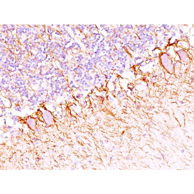 Immunohistochemistry - Anti-Neurofilament Heavy Polypeptide Antibody [SPM203] - BSA and Azide free (A252669) - Antibodies.com