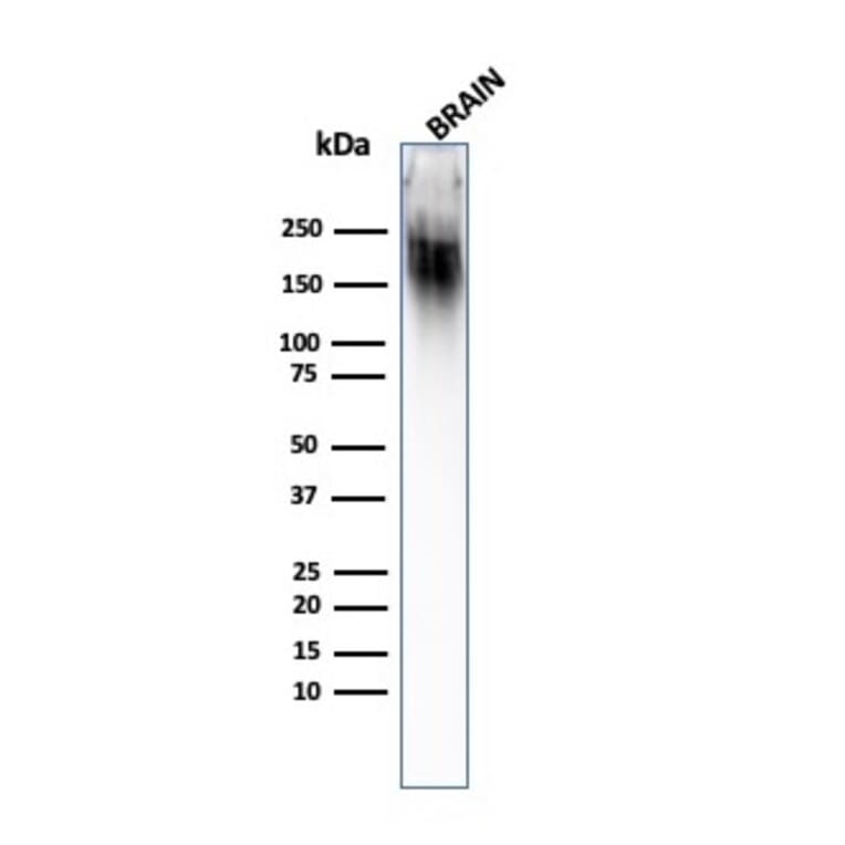 Western Blot - Anti-Neurofilament Heavy Polypeptide Antibody [SPM203] - BSA and Azide free (A252670) - Antibodies.com