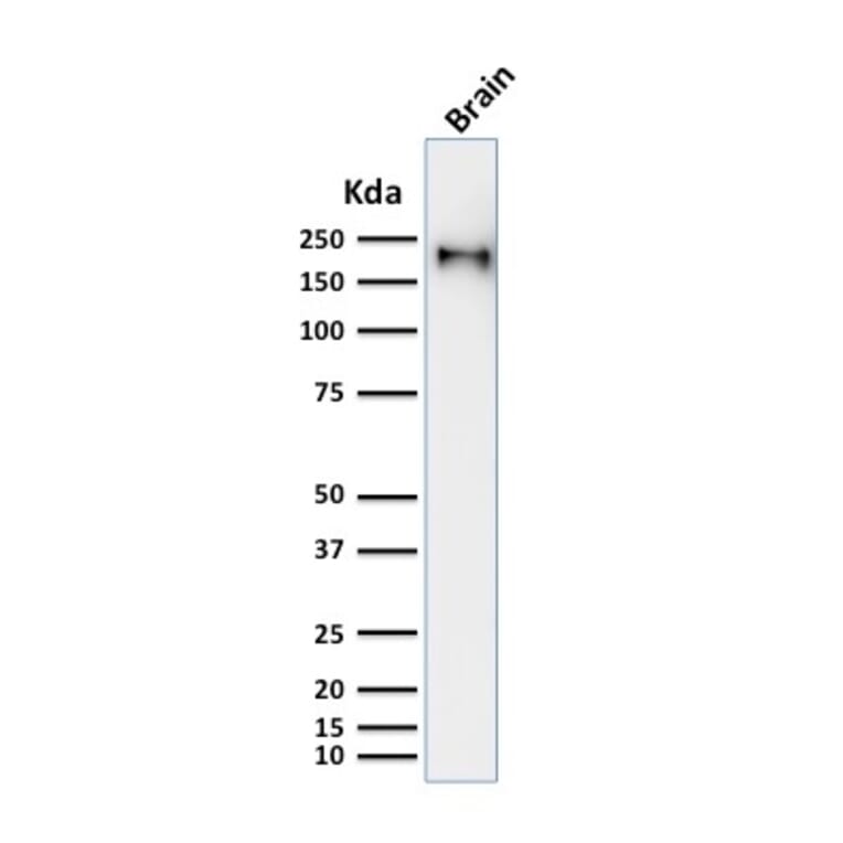 Western Blot - Anti-Neurofilament Heavy Polypeptide Antibody [rNF421] - BSA and Azide free (A252672) - Antibodies.com