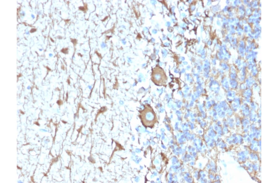 Immunohistochemistry - Anti-Neurofilament Heavy Polypeptide Antibody [NEFL.H/2324R] - BSA and Azide free (A252673) - Antibodies.com
