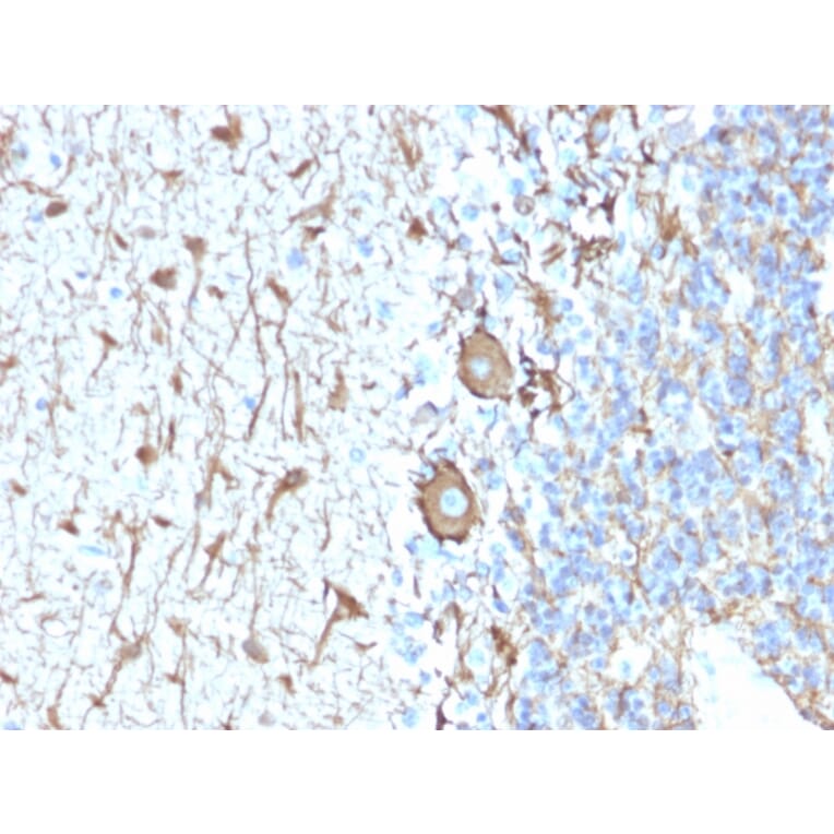 Immunohistochemistry - Anti-Neurofilament Heavy Polypeptide Antibody [NEFL.H/2324R] - BSA and Azide free (A252673) - Antibodies.com