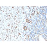 Immunohistochemistry - Anti-Neurofilament Heavy Polypeptide Antibody [NEFL.H/2324R] - BSA and Azide free (A252673) - Antibodies.com