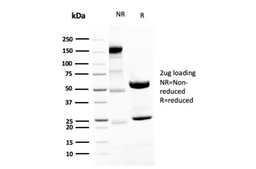 SDS-PAGE - Anti-Neurofilament Heavy Polypeptide Antibody [NEFL.H/2324R] - BSA and Azide free (A252673) - Antibodies.com