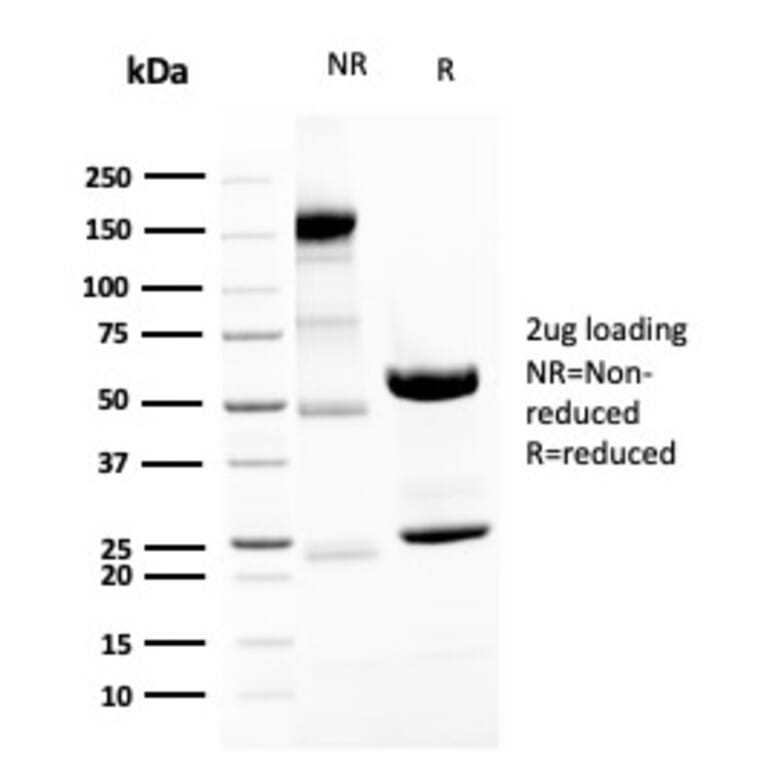 SDS-PAGE - Anti-Neurofilament Heavy Polypeptide Antibody [NEFL.H/2324R] - BSA and Azide free (A252673) - Antibodies.com