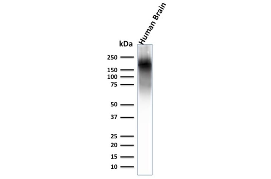 Western Blot - Anti-Neurofilament Heavy Polypeptide Antibody [NEFL.H/2324R] - BSA and Azide free (A252673) - Antibodies.com