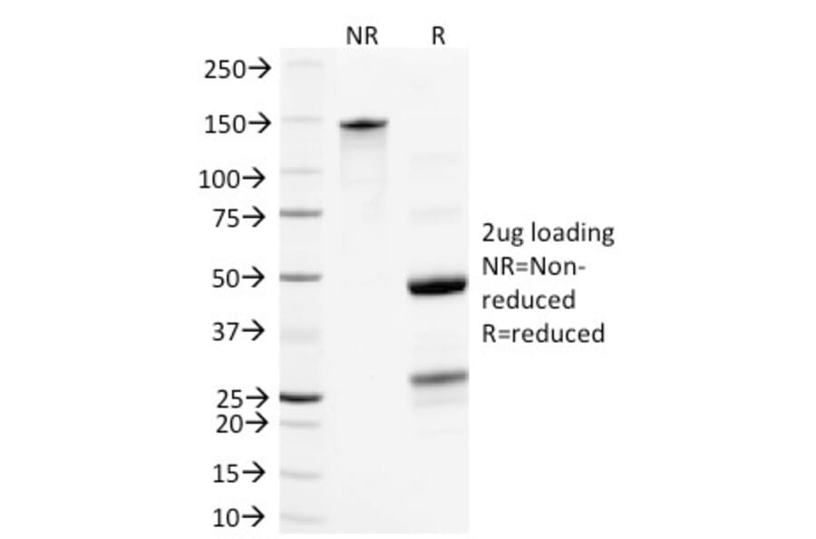 SDS-PAGE - Anti-NF-L Antibody [NR-4] - BSA and Azide free (A252674) - Antibodies.com