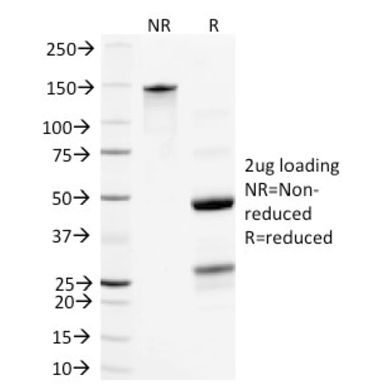 SDS-PAGE - Anti-NF-L Antibody [NR-4] - BSA and Azide free (A252674) - Antibodies.com