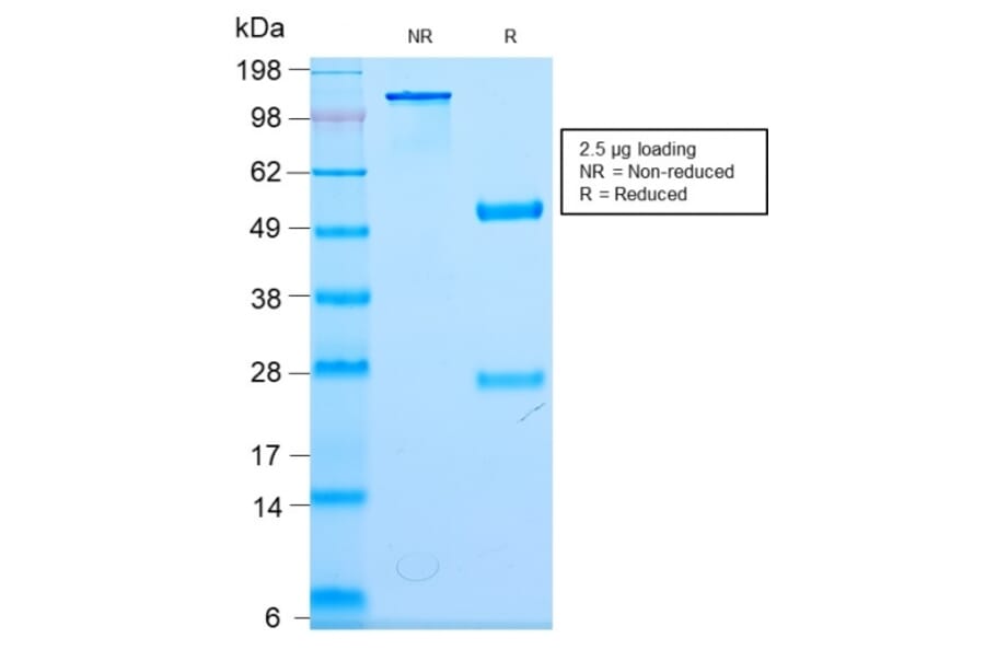 SDS-PAGE - Anti-NF-L Antibody [NEFL/2983R] - BSA and Azide free (A252677) - Antibodies.com