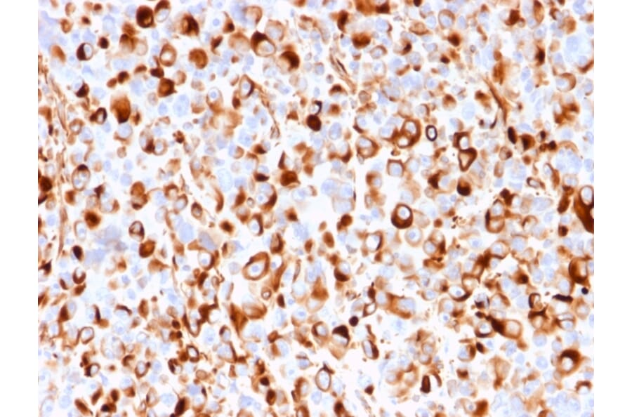 Immunohistochemistry - Anti-p75 NGF Receptor Antibody [rNGFR/1965] - BSA and Azide free (A252678) - Antibodies.com