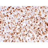 Immunohistochemistry - Anti-p75 NGF Receptor Antibody [rNGFR/1965] - BSA and Azide free (A252678) - Antibodies.com