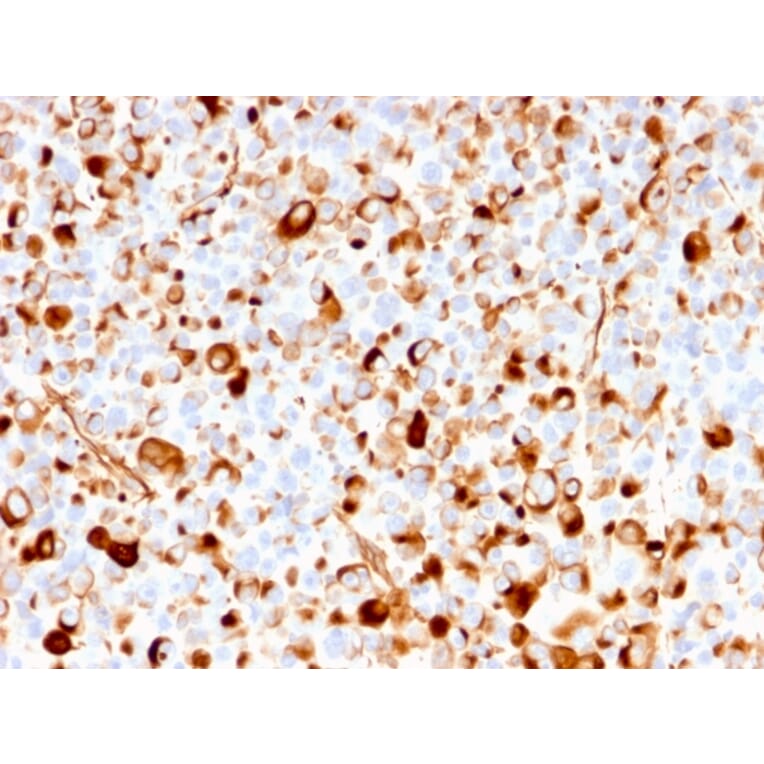Immunohistochemistry - Anti-p75 NGF Receptor Antibody [rNGFR/1965] - BSA and Azide free (A252677) - Antibodies.com