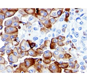 Immunohistochemistry - Anti-p75 NGF Receptor Antibody [NGFR5] - BSA and Azide free (A252679) - Antibodies.com