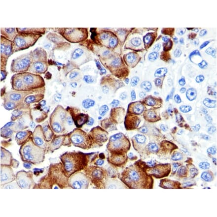 Immunohistochemistry - Anti-p75 NGF Receptor Antibody [NGFR5] - BSA and Azide free (A252679) - Antibodies.com