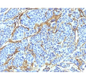 Immunohistochemistry - Anti-p75 NGF Receptor Antibody [NTR/912] - BSA and Azide free (A252681) - Antibodies.com