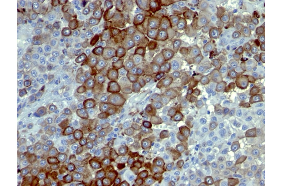Immunohistochemistry - Anti-p75 NGF Receptor Antibody [NTR/912] - BSA and Azide free (A252680) - Antibodies.com