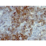Immunohistochemistry - Anti-p75 NGF Receptor Antibody [NTR/912] - BSA and Azide free (A252680) - Antibodies.com