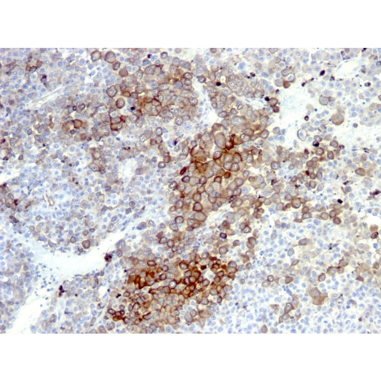 Immunohistochemistry - Anti-p75 NGF Receptor Antibody [NGFR5 + NTR/912] - BSA and Azide free (A252681) - Antibodies.com