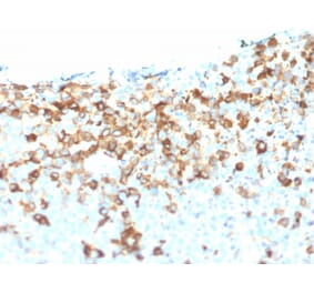 Immunohistochemistry - Anti-p75 NGF Receptor Antibody [NGFR/1964] - BSA and Azide free (A252683) - Antibodies.com