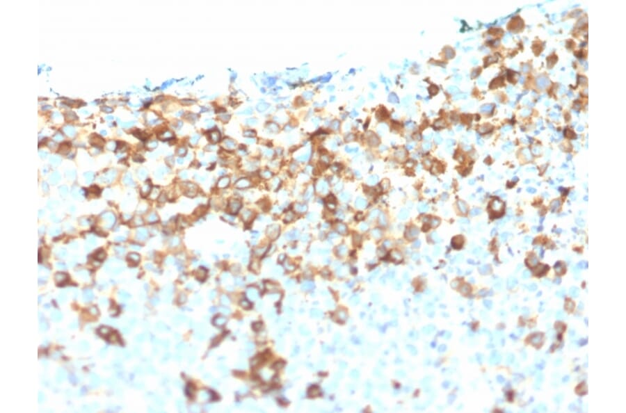 Immunohistochemistry - Anti-p75 NGF Receptor Antibody [NGFR/1964] - BSA and Azide free (A252683) - Antibodies.com