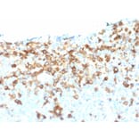 Immunohistochemistry - Anti-p75 NGF Receptor Antibody [NGFR/1964] - BSA and Azide free (A252683) - Antibodies.com
