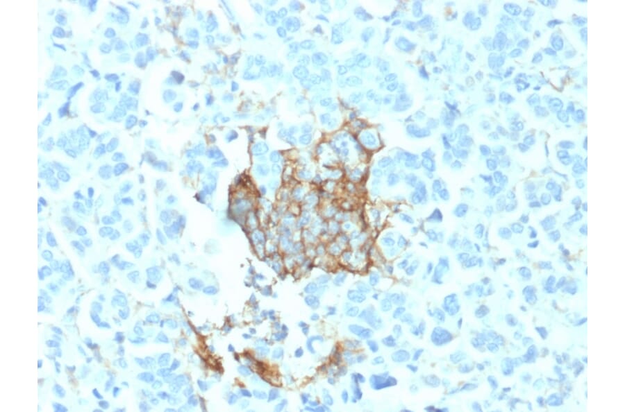 Immunohistochemistry - Anti-p75 NGF Receptor Antibody [NGFR/1964] - BSA and Azide free (A252683) - Antibodies.com